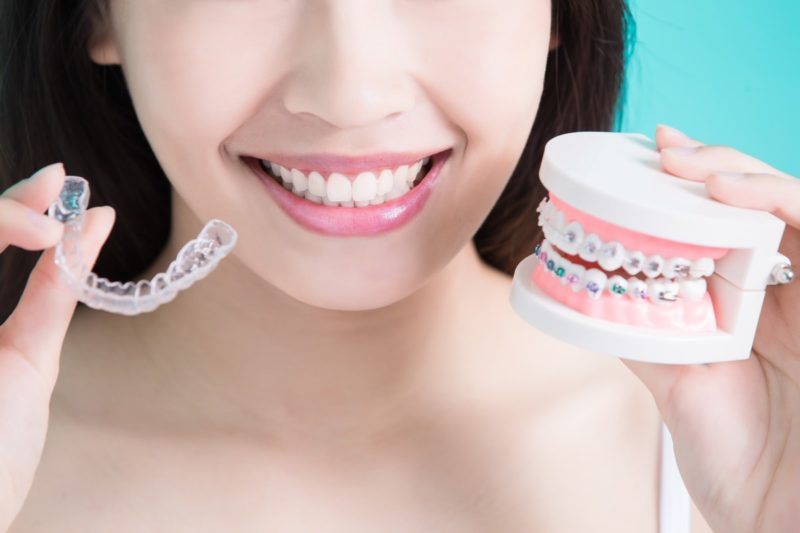 Metallic Braces VS Invisalign Braces - Whats best?! - Regent Dental UK